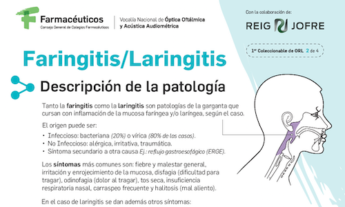 Ficha técnica: Lanringitis – Faringitis