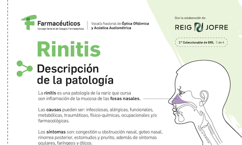 Ficha técnica: Rinitis