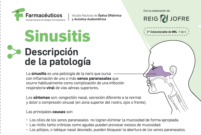 Ficha técnica: Sinusitis